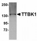TTBK1 Antibody (C-Terminus)