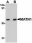 MATN1 / Matrilin 1 Antibody (C-Terminus)
