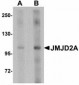 KDM4A / JHDM3A / JMJD2A Antibody (Internal)