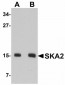 SKA2 Antibody (N-Terminus)