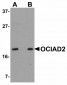 OCIAD2 Antibody (N-Terminus)