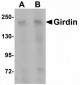 CCDC88A / GIV / Girdin Antibody (C-Terminus)