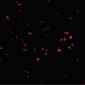 PARL / PSARL Antibody (N-Terminus)