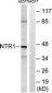 NTSR1 / NTR Antibody (aa181-230)