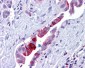 RBBP8 / CTIP Antibody (Internal)