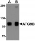 ATG9B Antibody (C-Terminus)