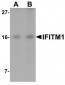 CD225 / IFITM1 Antibody (C-Terminus)