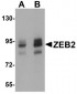 ZEB2 Antibody (C-Terminus)