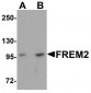 FREM2 Antibody (Internal)