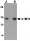 Calneuron-1 / CALN1 Antibody (N-Terminus)