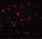 NOD3 / NLRC3 Antibody (Internal)