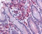 NOD3 / NLRC3 Antibody (Internal)