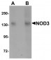 NOD3 / NLRC3 Antibody (Internal)