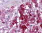 KPNA3 / Importin Alpha 4 Antibody (C-Terminus)