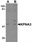KPNA3 / Importin Alpha 4 Antibody (C-Terminus)