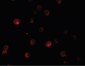 PAPPA2 / Pappalysin 2 Antibody (N-Terminus)