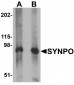 SYNPO / Synaptopodin Antibody (C-Terminus)