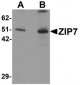 SLC39A7 / ZIP7 Antibody (N-Terminus)