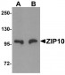 SLC39A10 / ZIP10 Antibody (Internal)