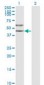 Alpha-1-Antichymotrypsin Antibody (clone 1E6)