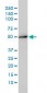 ACY1 / Aminoacylase 1 Antibody (clone 4F1-B7)