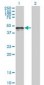CALR / Calreticulin Antibody (clone 1G11-1A9)