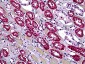 DHX9 Antibody (clone 3G7)