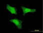 FGF1 Antibody (clone 1F9)