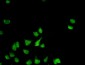 PHB / Prohibitin Antibody (clone 3F4-2B2)