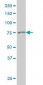 GSN / Gelsolin Antibody (clone 3G5)
