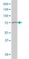 GSN / Gelsolin Antibody (clone 3G5)