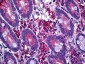 LIMK1 / LIMK Antibody (clone 1A8)