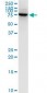 LIMK1 / LIMK Antibody (clone 1A8)