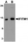 CD225 / IFITM1 Antibody (Internal)
