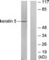 KRT5 / CK5 / Cytokeratin 5 Antibody (aa541-590)