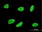 SGK1 / SGK Antibody (clone 3G8)