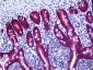 ESA / EPCAM Antibody (clone MOC-31)