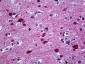 STXBP1 / MUNC18-1 Antibody (aa279-328)