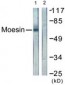 Ezrin + Radixin + Moesin Antibody (aa524-573)