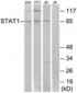STAT1 Antibody (aa694-743)