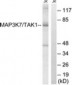 MAP3K7 / TAK1 Antibody (aa161-210)