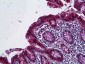 LGALS3 / Galectin 3 Antibody (aa141-190)