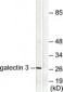 LGALS3 / Galectin 3 Antibody (aa141-190)