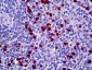HRS / HGS Antibody (aa451-500)