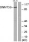 DNMT3B Antibody (aa1-50)