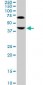 ABHD5 Antibody (clone 1F3)