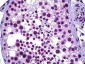 WT1 / Wilms Tumor 1 Antibody (clone 1E9)