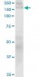 COL1A1 / Collagen I Alpha 1 Antibody (clone 3G3)