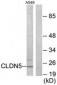 CLDN5 / Claudin 5 Antibody (aa169-218)