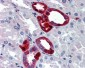 UCHL1 / PGP9.5 Antibody (aa171-220)